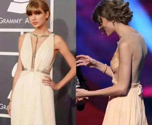 明星可以驼背吗,即使驼背，也能闪耀舞台